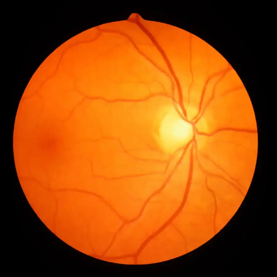 Retinal imaging used during diabetic eye exams in South Ogden, Utah